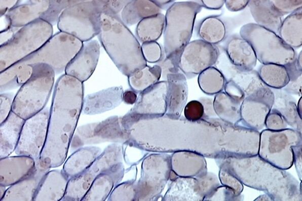 ćelije gljivica noktiju pod mikroskopom