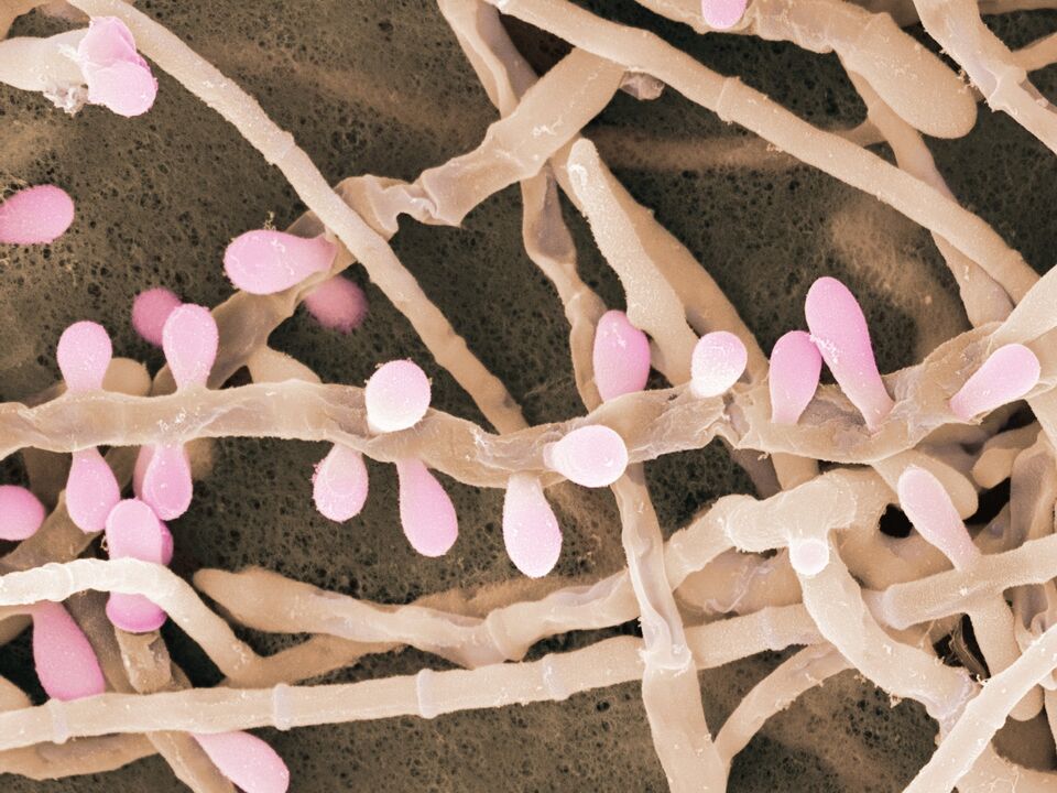 Trichophyton rubrum je vrsta gljivice koja pogađa kožu stopala.